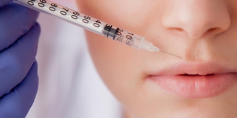 Graceful Enhancement: Transforming Your Lips with a Botox Lip Flip